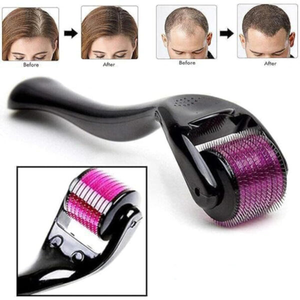 Derma Roller System - Image 12