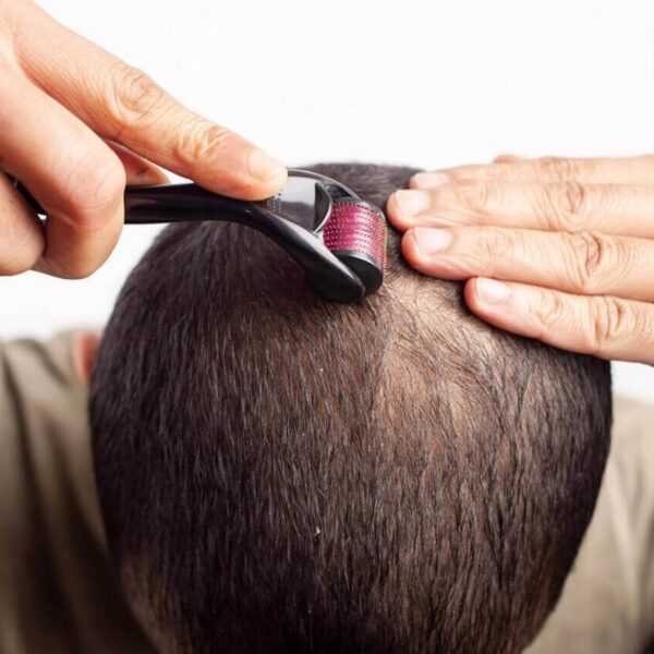 Derma Roller System - Image 13